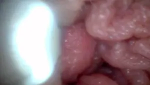 Endoscope camera shows the most sensitive parts of the penis Educational video